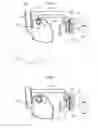 Fig. 03 - Device for treating obesity