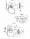 Fig. 11 - Device for treating obesity