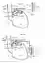 Fig. 14 - Device for treating obesity