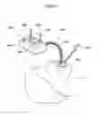 Fig. 25 - Device for treating obesity