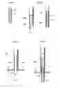 Fig. 30 - Device for treating obesity