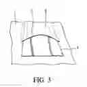 Fig. 04 - EXTERNAL POCKET FOR A PROTECTIVE SUIT