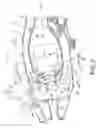 Fig. 04 - Gas turbine fuel injector mounting system
