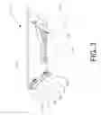 Fig. 04 - Cooler attachment