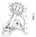 Fig. 04 - Single disc liquid fertilizer opener