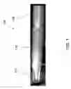 Fig. 02 - Concentric cutting assembly