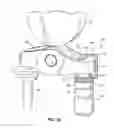Fig. 15 - COUPLING DEVICE