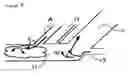 Fig. 04 - Nebulising device for use in a CPAP-system