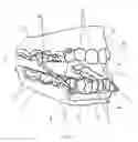 Fig. 02 - DEVICE FOR MANDIBULAR ADVANCEMENT