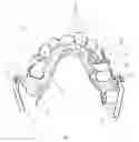 Fig. 04 - DEVICE FOR MANDIBULAR ADVANCEMENT
