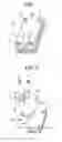 Fig. 02 - Stacked conduit assembly and screw fastening method for conduit part