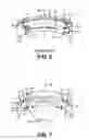 Fig. 05 - Non-collapsing built in place adjustable swage