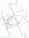 Fig. 16 - Stabilizing members for fixed cutter drill bit