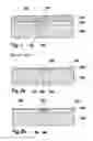 Fig. 02 - Micromechanical component and method for the manufacture thereof