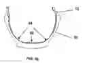 Fig. 07 - BLADDER, AN APPARATUS AND A METHOD FOR SHAPING AND CURING A TIRE