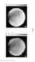 Fig. 06 - Phase sensitive radio frequency mapping for magnetic resonance imaging