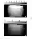 Fig. 07 - Phase sensitive radio frequency mapping for magnetic resonance imaging