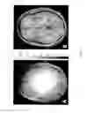 Fig. 08 - Phase sensitive radio frequency mapping for magnetic resonance imaging