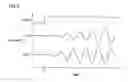 Fig. 04 - Oscillation circuit