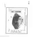 Fig. 05 - METHOD FOR INDICATING A NOISE LEVEL OF A ROTARY-WING AIRCRAFT