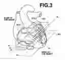 Fig. 04 - Diagnosis assisting apparatus, diagnosis assisting method, and storage medium in which a diagnosis assisting program is recorded