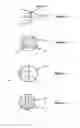 Fig. 02 - Contact lens and method for prevention of myopia progression