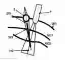 Fig. 01 - Device and Method for Performing Measurements During a Surgical Intervention by Means of an Optical Coherence Tomography Device