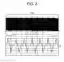 Fig. 03 - Magnetic transfer method and magnetic recording medium