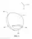 Fig. 04 - Lens