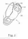 Fig. 03 - Lamp set for bicycle