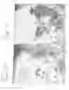 Fig. 07 - Tetrahedron beam computed tomography