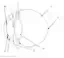 Fig. 01 - Intraoccular implant system with external lens and mirrors