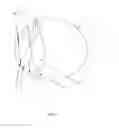 Fig. 02 - Intraoccular implant system with external lens and mirrors