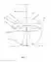 Fig. 06 - Intraoccular implant system with external lens and mirrors