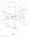 Fig. 07 - Intraoccular implant system with external lens and mirrors