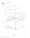 Fig. 09 - Intraoccular implant system with external lens and mirrors