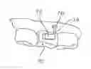 Fig. 01 - BONE CONDUCTION HEARING AID DEVICES AND METHODS