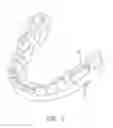 Fig. 08 - BONE CONDUCTION HEARING AID DEVICES AND METHODS