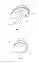 Fig. 03 - Frame earhook