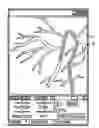 Fig. 01 - Medical apparatus and method of using the same for generating a virtual road map guide of a patient's anatomy and annotate the images