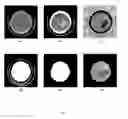 Fig. 08 -  Method and System of Segmenting CT Scan Data