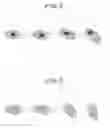 Fig. 07 - Method for distinguishing living cells during cell observation, image processing program for cell observation, and image processing device