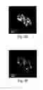 Fig. 09 - Sub-diffraction limit image resolution in three dimensions