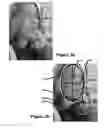 Fig. 05 - Digital image processing using face detection information
