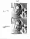 Fig. 05 - Method and apparatus for removing image noise