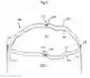 Fig. 04 - Embossed Drawtape for Polymeric Bags