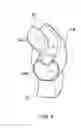 Fig. 05 - Actuatable seal for aerofoil blade tip
