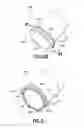 Fig. 54 - Continuous fluid delivery system