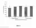 Fig. 03 - METHOD OF DETECTING MYOCARDIAL DYSFUNCTION IN PATIENTS HAVING A HISTORY OF ASTHMA OR BRONCHOSPASM