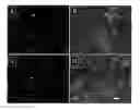 Fig. 01 - STABILIZATION OF MACROMOLECULAR MEMBRANES